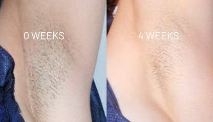 Cyperus Rotundus Oil