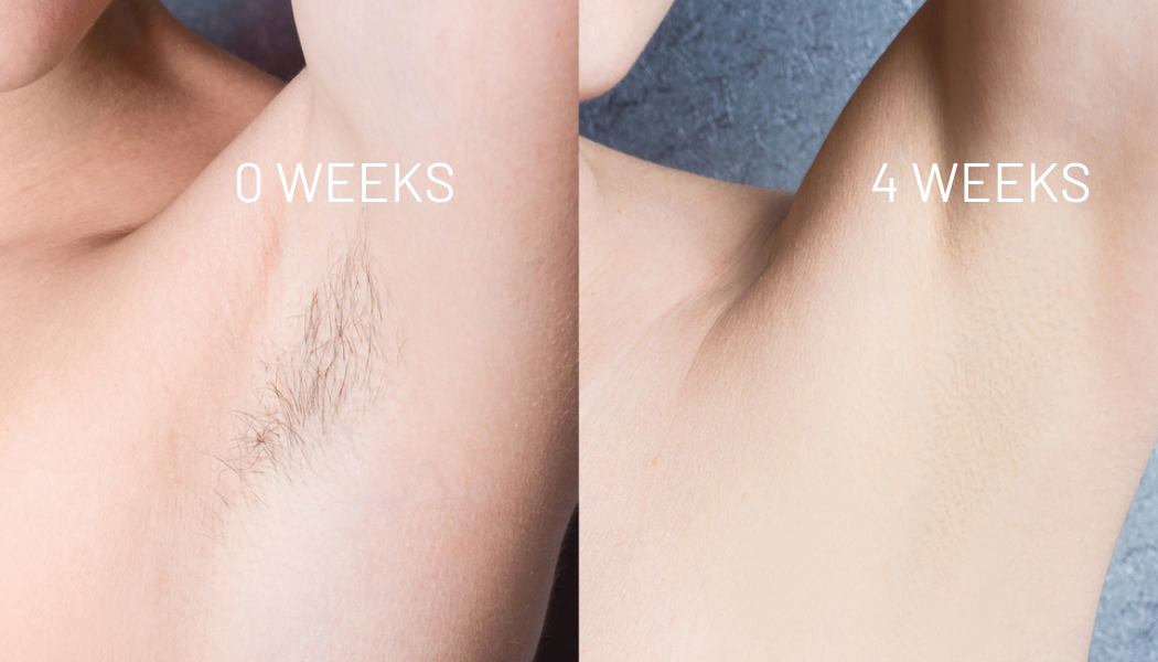 Cyperus Rotundus Oil