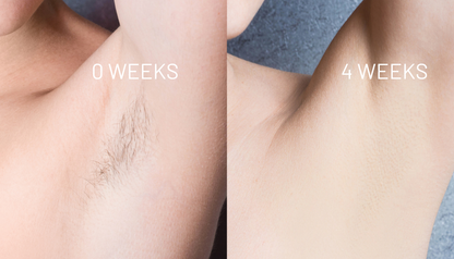 Cyperus Rotundus Oil